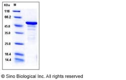 Sino Biological Recombinant Human ANP32A Protein (His & GST Tag), Quantity: