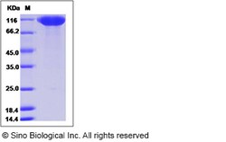 Sino Biological Recombinant Human Siglec-2/CD22 Protein (ECD, His Tag),
