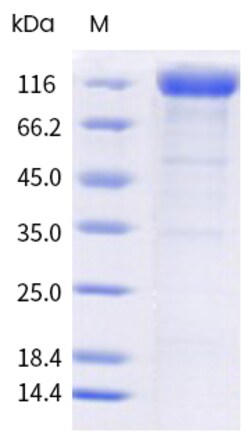 Sino Biological Recombinant Human LRP-6 Protein (hFc Tag), Quantity: Each