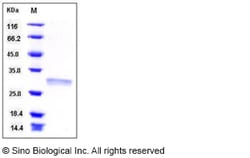 Sino Biological Recombinant Human RPE Protein (His Tag), Quantity: Each