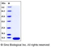 Sino Biological Recombinant Human Beta-2 microglobulin Protein (His Tag),