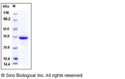 Sino Biological Human HIF-1 alpha / HIF1A Protein (His Tag) 100ug, Quantity: