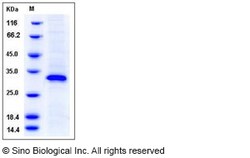 Sino Biological Human EGFL7 / VE-statin Protein (His Tag) 100ug, Quantity:
