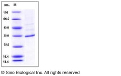 Sino Biological Recombinant Human FANCA Protein (His Tag), HPLC-verified,