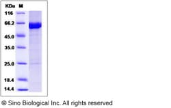 Sino Biological Recombinant Human KEAP1 Protein, HPLC-verified, Quantity: