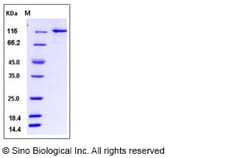 Sino Biological Recombinant Human Ubiquitin Activating Enzyme E1/UBA1 Protein