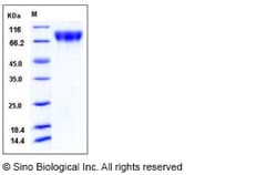 Sino Biological Human c-KIT / CD117 Protein (ECD, His Tag) 100ug, Quantity: