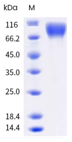 Sino Biological Human KIT Protein 100ug (Sino Biological), Quantity: Each