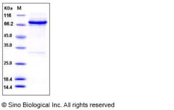 Sino Biological Recombinant Human RET Protein (aa 658-1114, His & GST Tag),