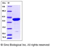 Sino Biological Human Galectin-7 / LGALS7 Protein (GST Tag) 100ug, Quantity: