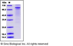 Sino Biological Human PPARG / Nr1c3 / PPARgamma Protein (His & GST Tag)