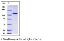 Sino Biological Recombinant Human Vitamin D Receptor/VDR Protein (His Tag),