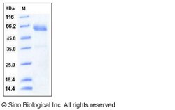 Sino Biological Recombinant Human SMOC-1 Protein (His Tag), Quantity: Each