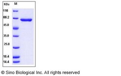 Sino Biological Recombinant Human HEXA Protein (Subunit A, His Tag), Quantity: