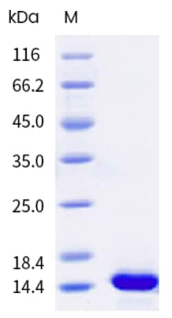 Sino Biological Human NR3C1 Protein 100ug (Sino Biological), Quantity: