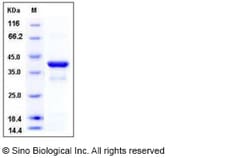 Sino Biological Recombinant Human IkB alpha Protein (His Tag), Quantity: