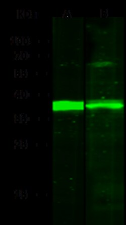 Sino Biological Human NFKBIA MAb 100ul (Sino Biological), Quantity: Each