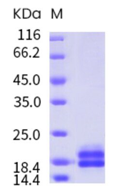 Sino Biological Recombinant Human IL-17A Protein (T26A, His Tag), Quantity: