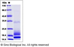 Sino Biological Human IL17 / IL17A Protein 5ug, Quantity: Each of 1