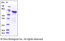 Sino Biological Human RELA / Transcription factor p65 / NFkB p65 Protein