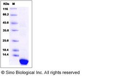Sino Biological Recombinant Human Pepsinogen C/PGC Protein (His Tag), Quantity: