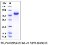 Sino Biological Recombinant Human GLA/alpha-Galactosidase A Protein (His