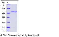 Sino Biological SARS-CoV-2 (2019-nCoV) Spike S1(HV69-70 deletion, N501Y,