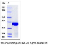 Sino Biological Human BCL6 / B-cell CLL lymphoma 6 Protein (aa 1-150, His