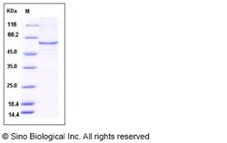 Sino Biological Human CAT / Catalase Protein (His Tag) 50ug, Quantity:
