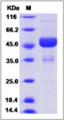 Sino Biological Human EFNA4 Protein 100ug (Sino Biological), Quantity: