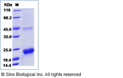 Sino Biological Human Prealbumin / Transthyretin / TTR / PALB Protein (His