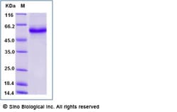 Sino Biological Human TNFRSF25 / DR3 / TNFRSF12 Protein (Fc Tag) 1mg, Quantity: