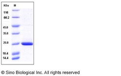Sino Biological Recombinant Human RAC2 Protein (His Tag), Quantity: Each