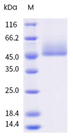Sino Biological&nbsp;Recombinant Human SLC2A1 Protein (Nanodisc, His Tag) 100 µg