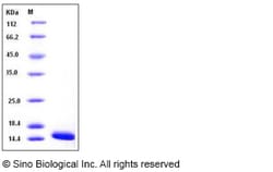 Sino Biological Recombinant Human FABP4/A-FABP Protein (29 Ala/Thr, His