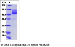 Sino Biological Recombinant Human MUC-1 Protein (mFc Tag), Quantity: Each