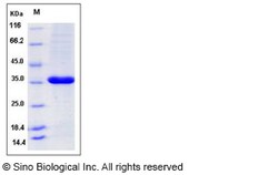 Sino Biological Recombinant Human PCNA Protein (His Tag), HPLC-verified,
