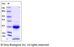 Sino Biological Recombinant Mouse IL-16 Protein (His Tag), Quantity: Each