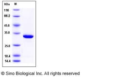 Sino Biological Recombinant Human Carbonic Anhydrase VII Protein (His Tag)