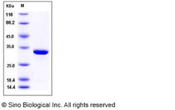 Sino Biological Recombinant Human Carbonic Anhydrase VII Protein (His Tag),