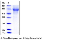 Sino Biological Human TIM4 / TIMD4 Protein (His Tag) 100ug, Quantity: Each