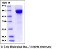 Sino Biological Recombinant Human VSIG4 Protein (hFc Tag), Quantity: Each