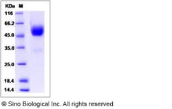 Sino Biological Recombinant Human SIGIRR Protein (hFc Tag) 1, Quantity: