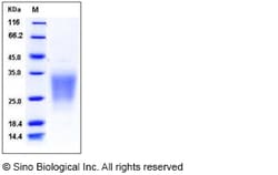Sino Biological Recombinant Human SIGIRR Protein (His Tag), HPLC-verified