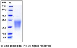 Sino Biological Human SIGIRR / TIR8 Protein (His Tag) 100ug, Quantity: