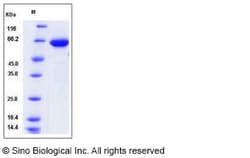 Sino Biological Human AFP / alpha-fetoprotein Protein (His Tag) 1mg, Quantity: