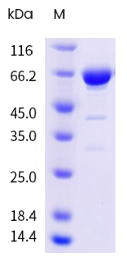 Sino Biological&nbsp;Recombinant Human Alpha-fetoprotein Protein (His & AVI Tag), Avi-tag Biotinylated, HPLC-verified 20 µg