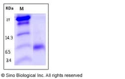 Sino Biological Recombinant Human Neuregulin-4/NRG4 Protein 1, Quantity: