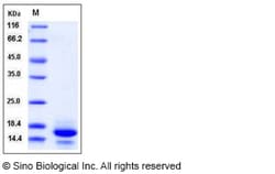 Sino Biological Recombinant Human IL-6R Protein (ECD, His & AVI Tag), Avi-tag