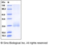 Sino Biological Recombinant Human CD160 Protein (His Tag), Quantity: Each